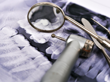 Stock photo of dentist tools on top of xray of teeth
