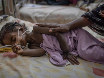 Two-year-old Riham Ata, who was admitted from a recently liberated area of Khartoum, lies on a gurney in one of Al-Buluk Hospital's severe malnutrition wards, in Omdurman, Sudan, on April 26, 2025