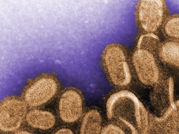 This colorized negative stained transmission electron microscopic (TEM) image shows recreated 1918 influenza virions that were collected from supernatants of 1918-infected Madin-Darby Canine Kidney (MDCK) cells cultures 18 hours after infection.