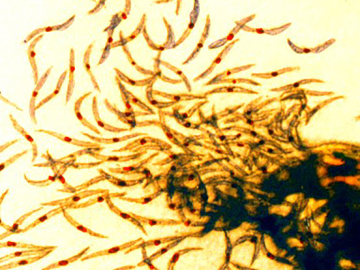 Malaria sporozoites, the infectious form of the malaria parasite that is injected into people by mosquitoes. Image/NIAID