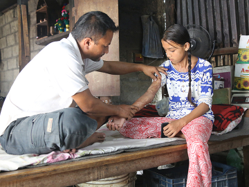 Saraswoti, who suffered terrible burns when she stumbled into a pot of oil heating on the open-fire stove in the middle of her family’s one-room home, sits with her father.