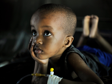 Mohammed, suffering from malaria, recovers at a Burundian run clinic in Somalia's capital, Mogadishu.