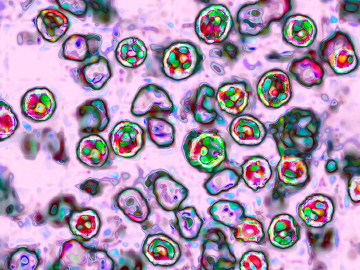 The measles virus, paramyxoviridae from the Morbillivirus family, transmission microscopy view. Image: BSIP/Universal Images Group via Getty