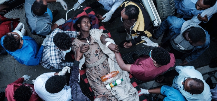 An injured resident of Togoga arrives at the Ayder referral hospital in Mekele, the capital of Tigray region, Ethiopia, on June 23, 2021. Yasuyoshi CHIBA / AFP via Getty Images