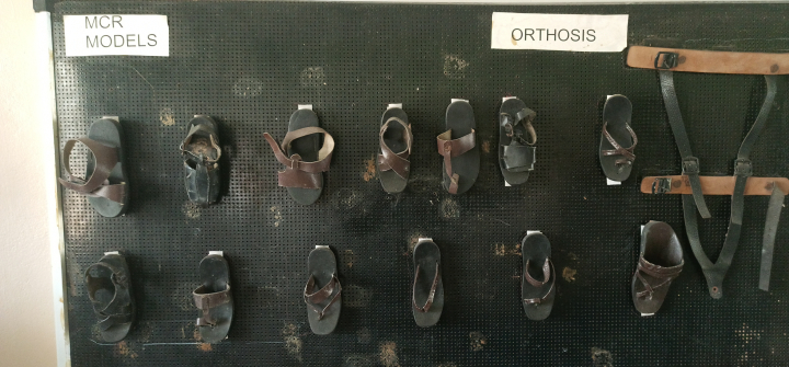 Custom-made microcellular rubber sandals are manufactured and given free of charge to patients at The Leprosy Mission Trust Hospital in Dayapuram, Manamadurai, for relief from foot ulcers and the management of leprosy-related disabilities. Kamala Thiagarajan