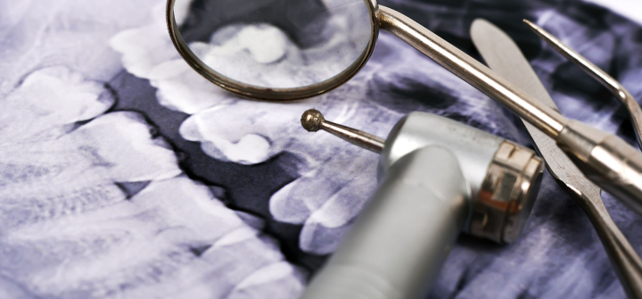 Stock photo of dentist tools on top of xray of teeth