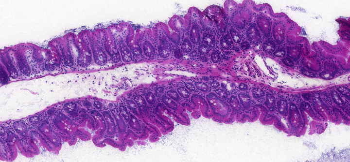 Microscope section showing 622A_cecum through a healthy mouse cecum stained with Haematoxylin-eosin