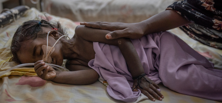 Two-year-old Riham Ata, who was admitted from a recently liberated area of Khartoum, lies on a gurney in one of Al-Buluk Hospital's severe malnutrition wards, in Omdurman, Sudan, on April 26, 2025