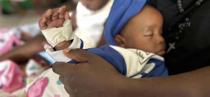 Olivia Nansamba holds her son Melvin’s bandaged, swollen hand as he rests.