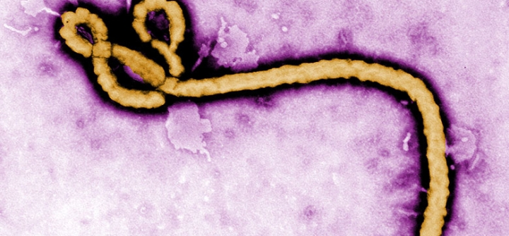 photo of Ebola virus