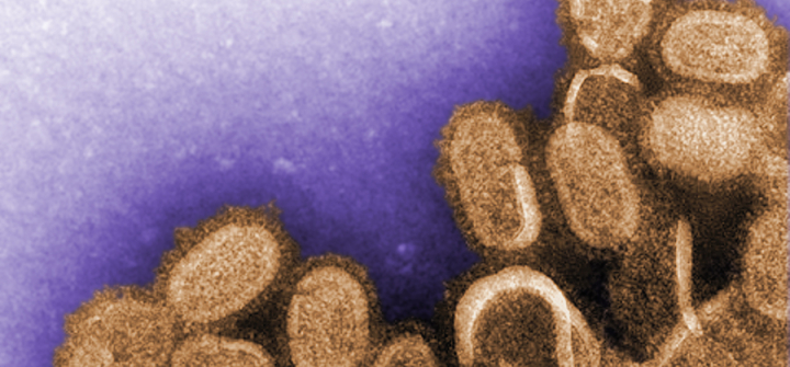 This colorized negative stained transmission electron microscopic (TEM) image shows recreated 1918 influenza virions that were collected from supernatants of 1918-infected Madin-Darby Canine Kidney (MDCK) cells cultures 18 hours after infection.