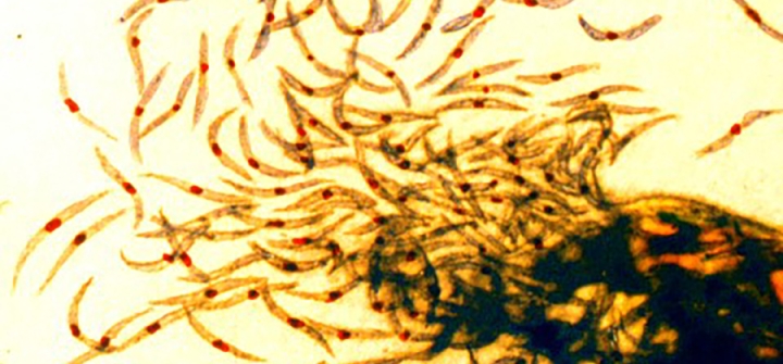 Malaria sporozoites, the infectious form of the malaria parasite that is injected into people by mosquitoes. Image/NIAID