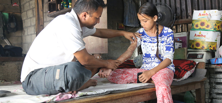 Saraswoti, who suffered terrible burns when she stumbled into a pot of oil heating on the open-fire stove in the middle of her family’s one-room home, sits with her father.