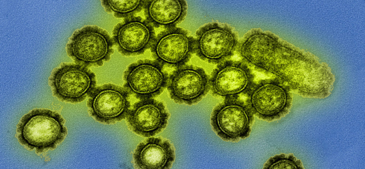 H1N1 influenza virus particles