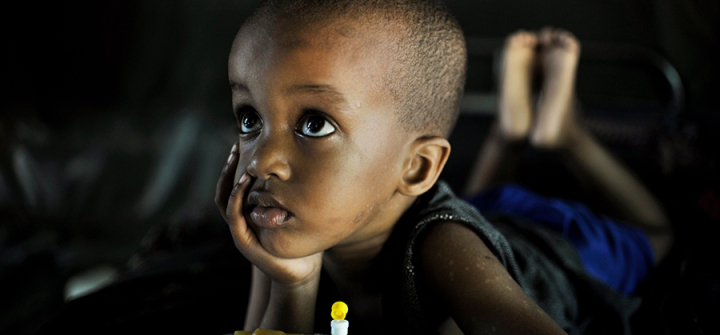 Mohammed, suffering from malaria, recovers at a Burundian run clinic in Somalia's capital, Mogadishu. 