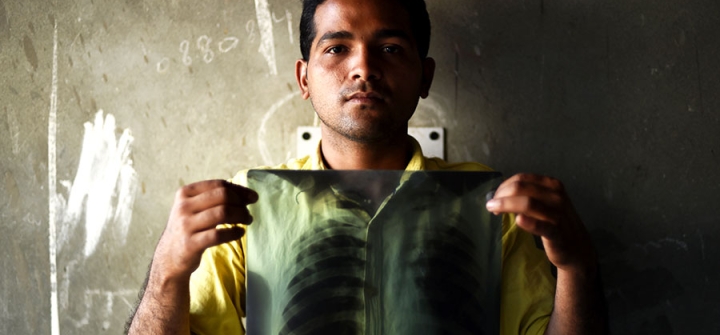 Indian TB patient Sonu Verma, 25, poses with his chest x-ray in Sonipat, March 3, 2016. Image: Money Sharma/AFP/Getty