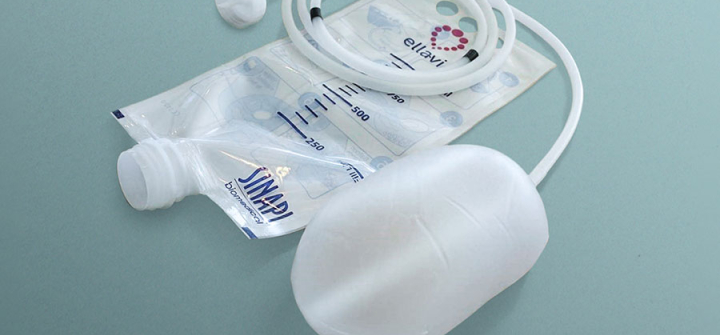 The Ellavi Uterine balloon Tamponade