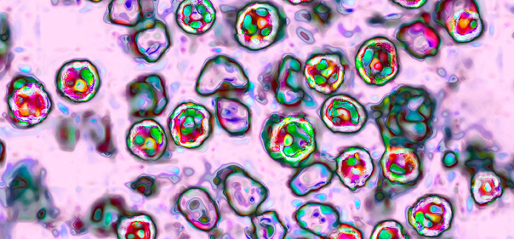 The measles virus, paramyxoviridae from the Morbillivirus family, transmission microscopy view. Image: BSIP/Universal Images Group via Getty