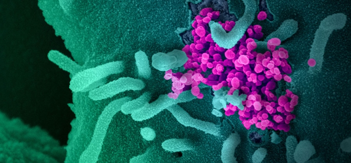 This scanning electron microscope image shows SARS-CoV-2 (round magenta objects) emerging from the surface of cells cultured in the lab. SARS-CoV-2, also known as 2019-nCoV, is the virus that causes COVID-19. The virus shown was isolated from a patient in the U.S. Credit: NIAID-RML