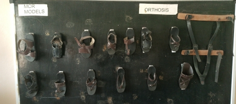 Custom-made microcellular rubber sandals are manufactured and given free of charge to patients at The Leprosy Mission Trust Hospital in Dayapuram, Manamadurai, for relief from foot ulcers and the management of leprosy-related disabilities. Kamala Thiagarajan