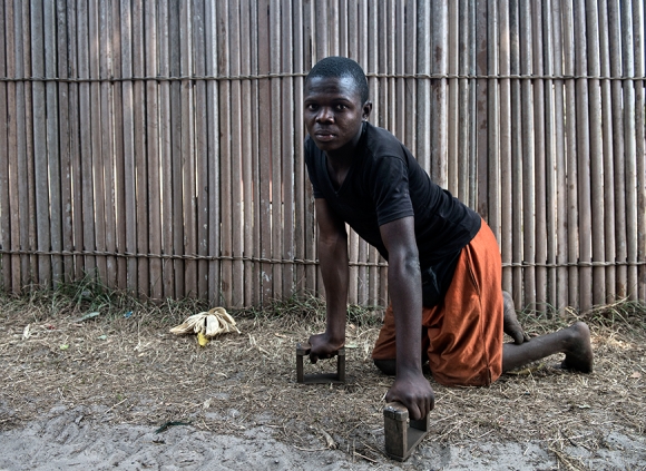 Again Kakene, 18, has had Konzo since 2002 and relies on wooden blocks to drag himself to the market and visit friends. He is the only one in his family with Konzo.